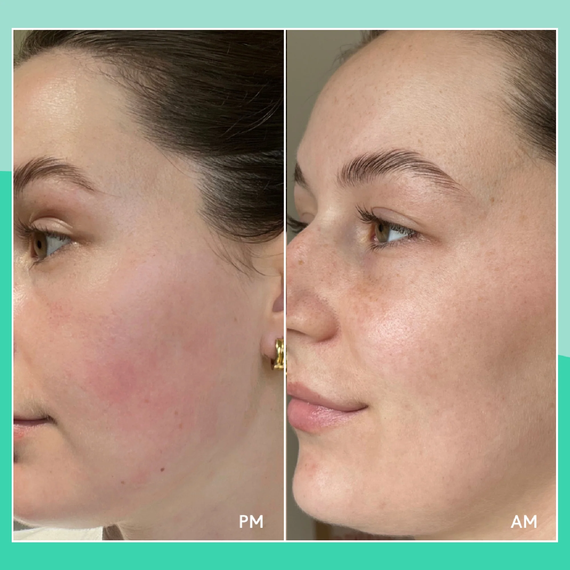 Cica Overnight Mask - Image 4