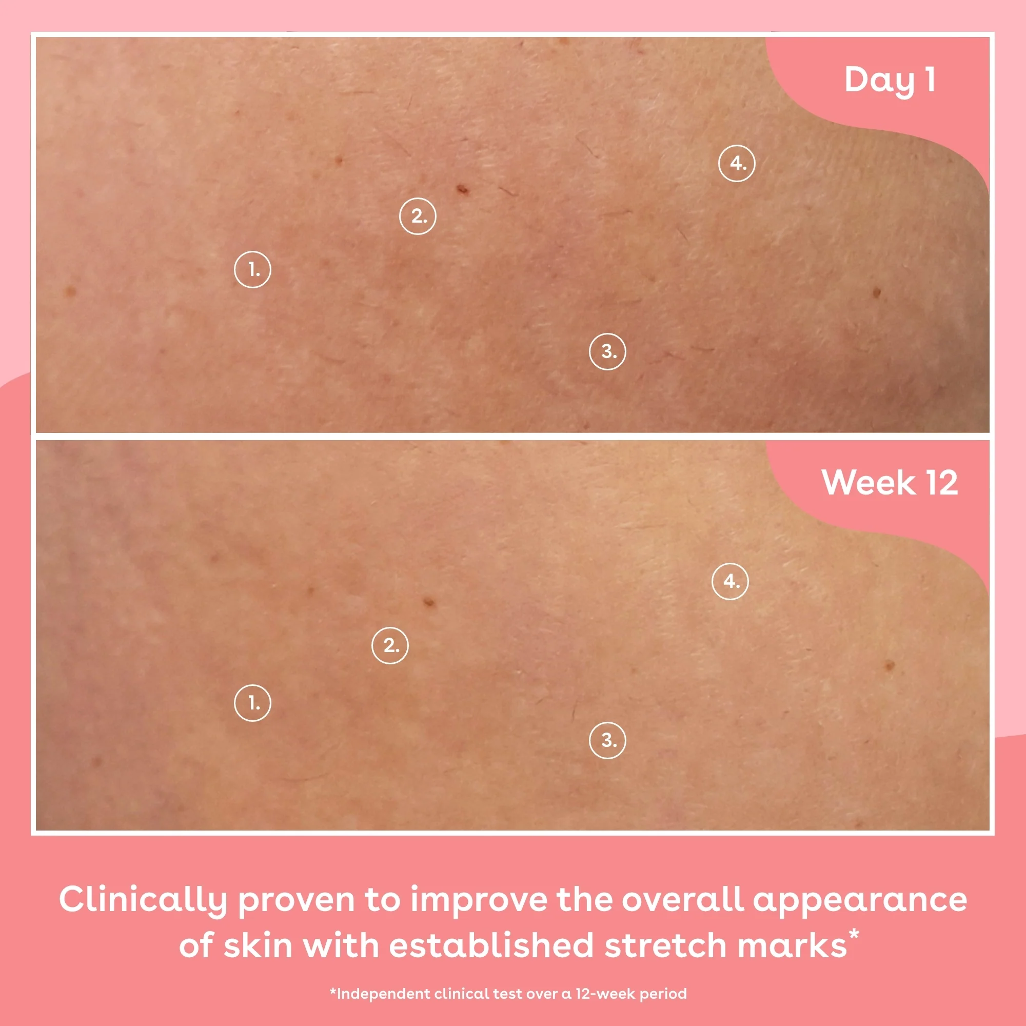 Collagen Body Oil - Image 10