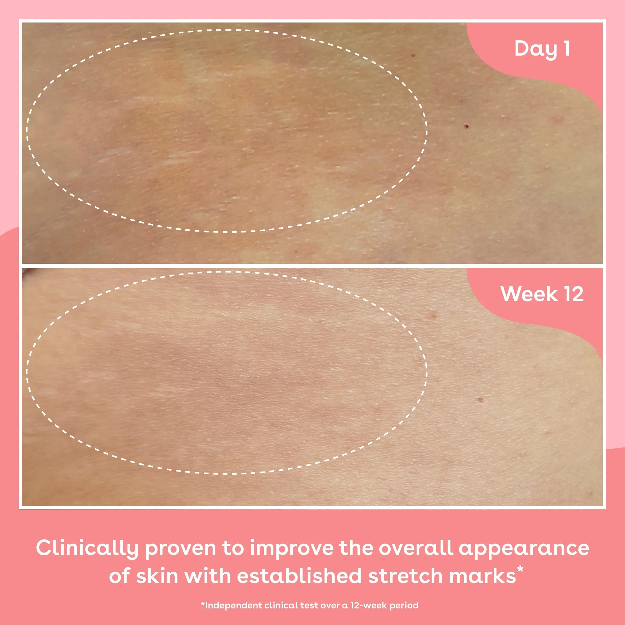 Collagen Body Oil - Image 3